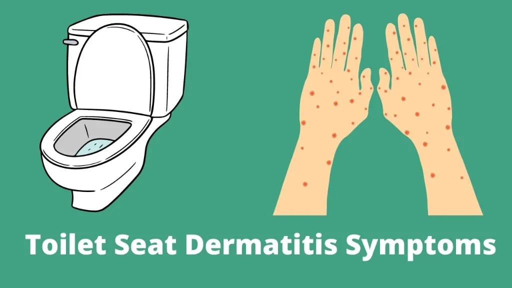 toilet seat dermatitis symptoms