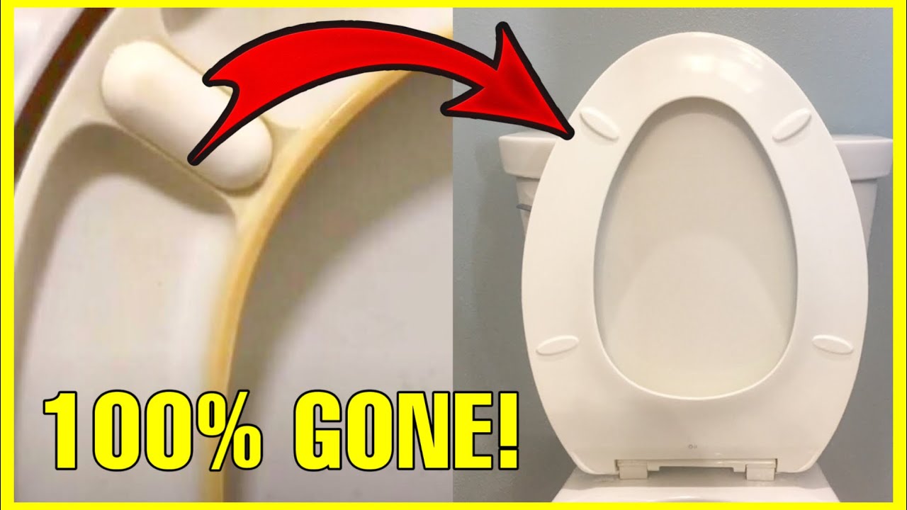 How To Whiten Toilet Seat?